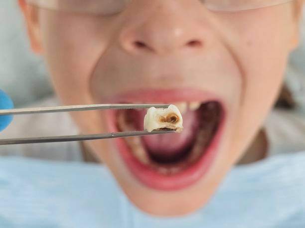 Best Tooth Infection Emergency Dentist  in Kittitas, WA